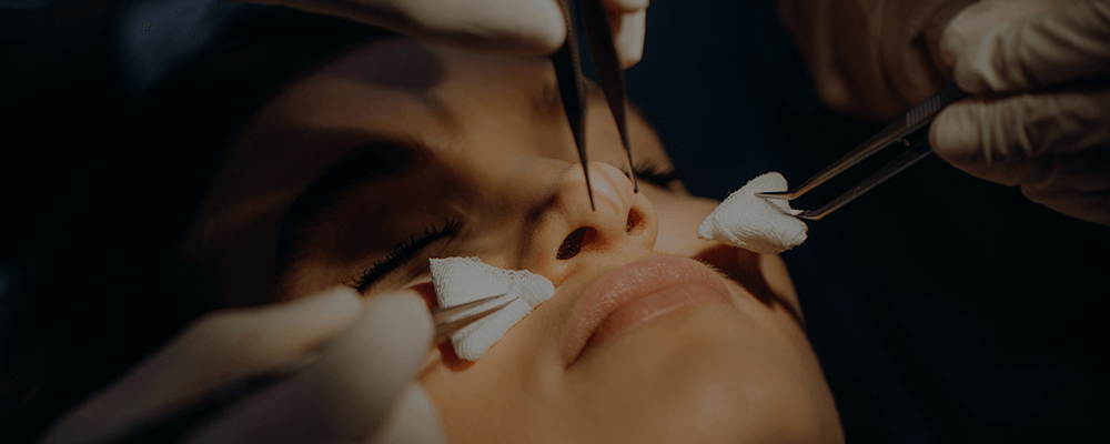 Rinoplastia​