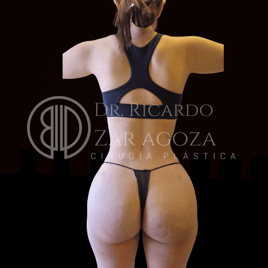 1 2lipoescultura