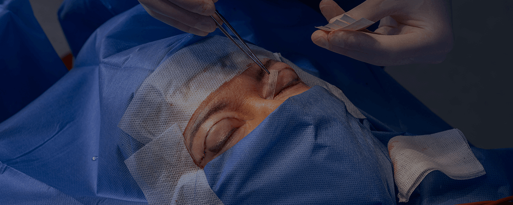 Blefaroplastia